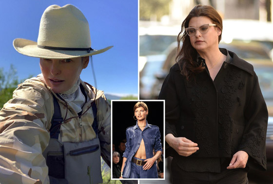 عارضة أزياء تطالب بـ50 مليون دولار تعويضا بعد تشوهها بعملية تجميل! صورة رقم 5