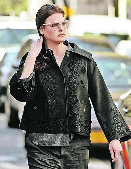 عارضة أزياء تطالب بـ50 مليون دولار تعويضا بعد تشوهها بعملية تجميل! صورة رقم 7