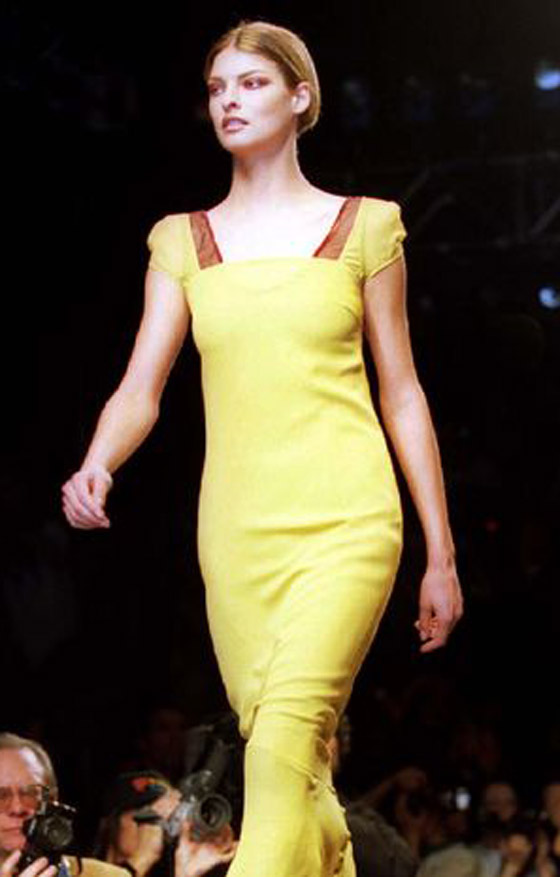 عارضة أزياء تطالب بـ50 مليون دولار تعويضا بعد تشوهها بعملية تجميل! صورة رقم 18