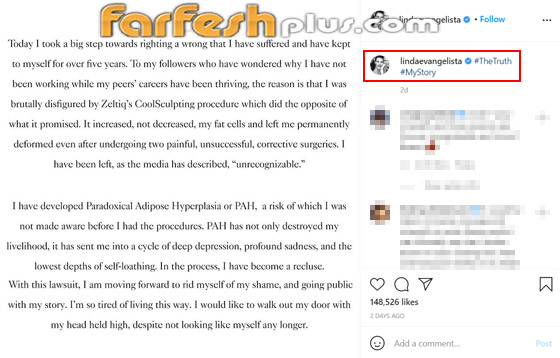 عارضة أزياء تطالب بـ50 مليون دولار تعويضا بعد تشوهها بعملية تجميل! صورة رقم 1