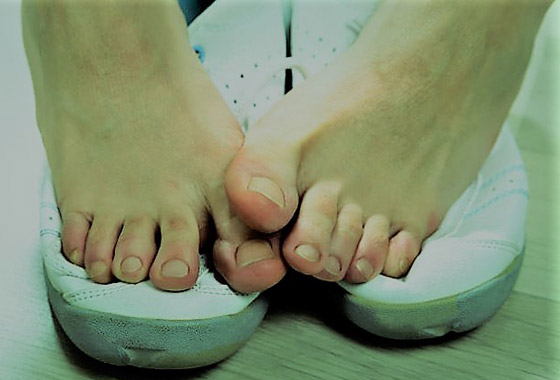 منها الجوارب الملونة.. 5 أسباب وراء رائحة أظافر القدم الكريهة صورة رقم 6