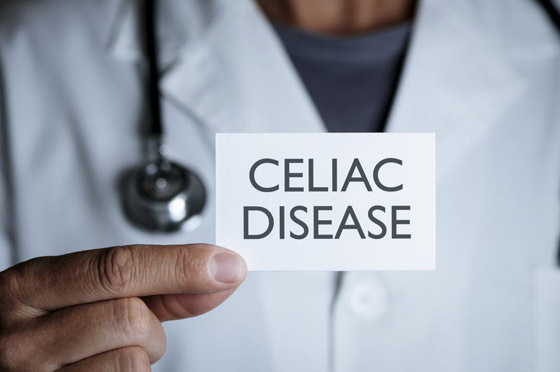 حساسية الأمعاء على الغلوتين: تجنبوا هذه الأطعمة! صورة رقم 4