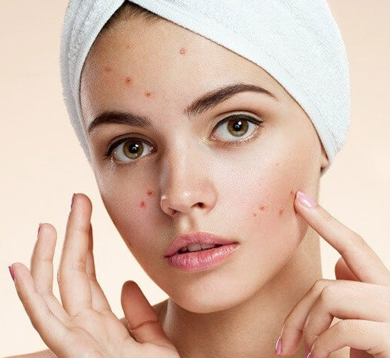 نظام غذائي يجب تناوله.. وفقاً لنوع بشرتك صورة رقم 5