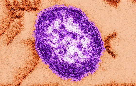 ليس بسبب كورونا.. العالم يواجه خطر تفشي 