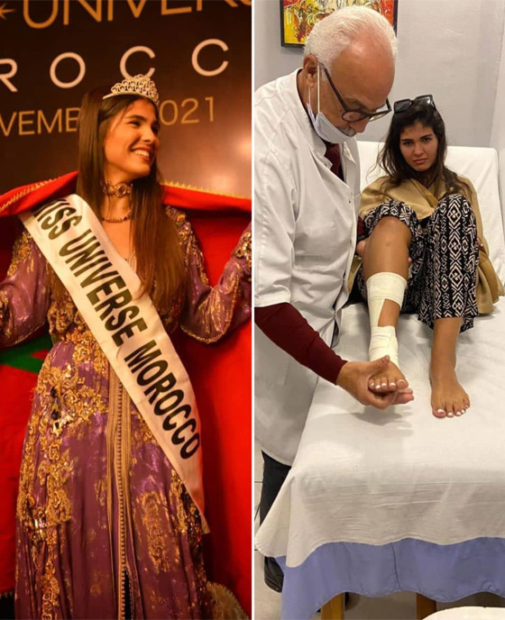 ملكة جمال المغرب تتنازل عن لقبها وتغيب عن مسابقة ملكة جمال الكون في إسرائيل.. والسبب؟ صورة رقم 5