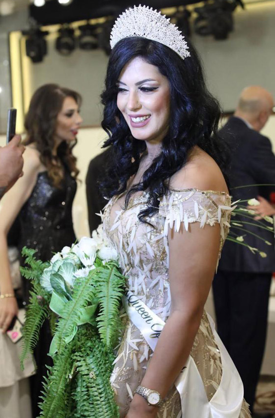 صور وفيديوهات من مسابقة للنساء اللاتي خسرن الوزن الزائد والملكة تعترف: عانيت من تنمر زوجي! صورة رقم 1 صور وفيديوهات من مسابقة للنساء اللاتي خسرن الوزن الزائد والملكة تعترف: عانيت من تنمر زوجي! صورة رقم 1