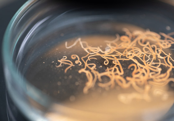 منها حبوب بها ديدان!.. تعرفوا إلى أغرب حميات الرجيم في التاريخ صورة رقم 1