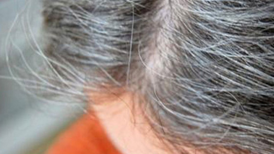 هكذا تتعاملين مع الشعر الأبيض صورة رقم 1