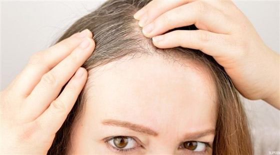 هكذا تتعاملين مع الشعر الأبيض صورة رقم 4