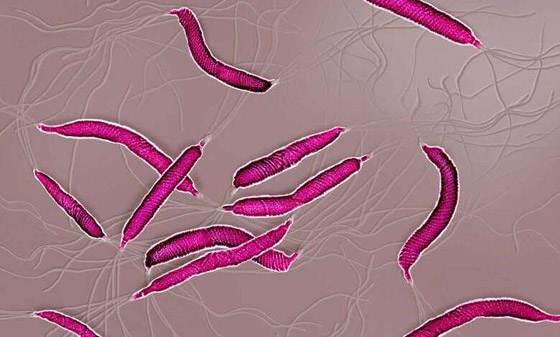 جرثومة المعدة.. أعراضها الصحية والنفسية وعلاجها بالأعشاب صورة رقم 6
