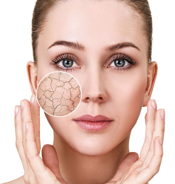 تعرفوا إلى أهم أسباب البشرة الجافة وكيفية حمايتها في فصل الشتاء صورة رقم 3 تعرفوا إلى أهم أسباب البشرة الجافة وكيفية حمايتها في فصل الشتاء صورة رقم 3