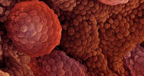 البيض يرفع خطر الإصابة بسرطان البروستاتا صورة رقم 3