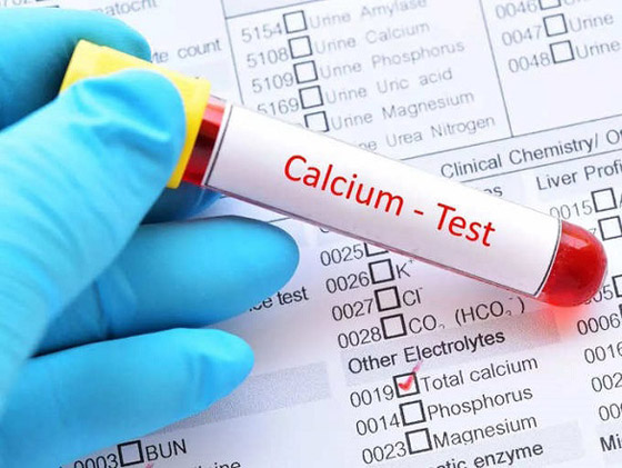 أهم الآثار الجانبية للإفراط في تناول فيتامين د صورة رقم 2