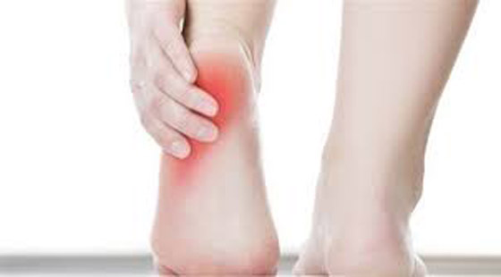 نصائح لعلاج آلام كعب القدمين صورة رقم 5