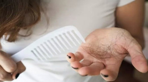 أفضل وضعيات يوغا للتقليل من تساقط الشعر الناجم عن كورونا صورة رقم 1