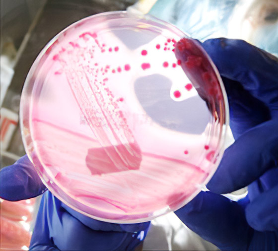 ماذا نعرف عن فيروس ماربورغ الجديد الفتاك؟ تسجيل أول وفاة في غينيا صورة رقم 8