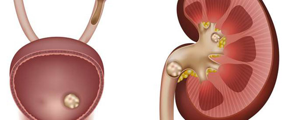 الكالسيوم وفيتامين D والرياضة.. ثالوث للتمتع بعظام قوية صورة رقم 5