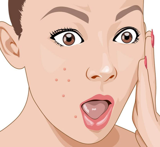 ماسك القرفة واللبن لعلاج حب الشباب والتخلص من حفر الوجه صورة رقم 5