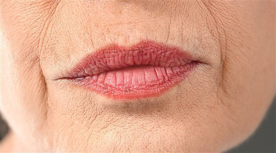 قبل البوتوكس.... نصائح لتخفيف التجاعيد حول الفم صورة رقم 1