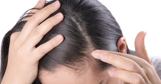 أضرار لشعرك يُسببها التوقف عن شرب القهوة صورة رقم 2