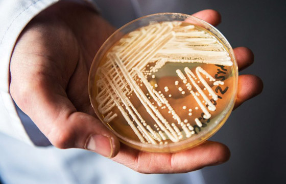 داء فطر البقع البيضاء.. تحذير من بكتيريا نادرة تشكل تهديدا عالميا! صورة رقم 1 داء فطر البقع البيضاء.. تحذير من بكتيريا نادرة تشكل تهديدا عالميا! صورة رقم 1