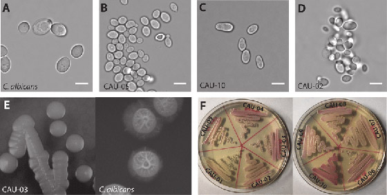 داء فطر البقع البيضاء.. تحذير من بكتيريا نادرة تشكل تهديدا عالميا! صورة رقم 6 داء فطر البقع البيضاء.. تحذير من بكتيريا نادرة تشكل تهديدا عالميا! صورة رقم 6