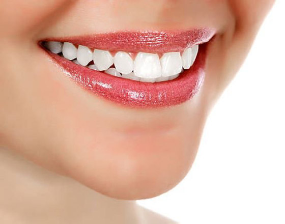 إليكم 4 طرق منزلية فعالة لتبييض الأسنان صورة رقم 7 إليكم 4 طرق منزلية فعالة لتبييض الأسنان صورة رقم 7