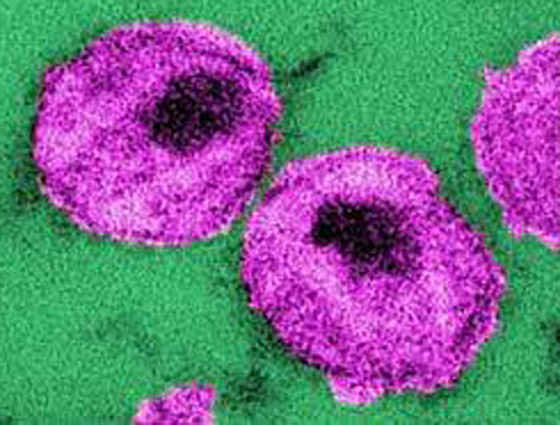 بعيدا عن كورونا.. متحور جديد لمرض خطير يهدد البشر! صورة رقم 2