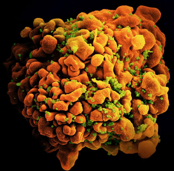 بعيدا عن كورونا.. متحور جديد لمرض خطير يهدد البشر! صورة رقم 4