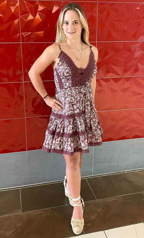 صور: فيكتوريا سيكرت تضم أول عارضة أزياء مصابة بمتلازمة داون صورة رقم 10