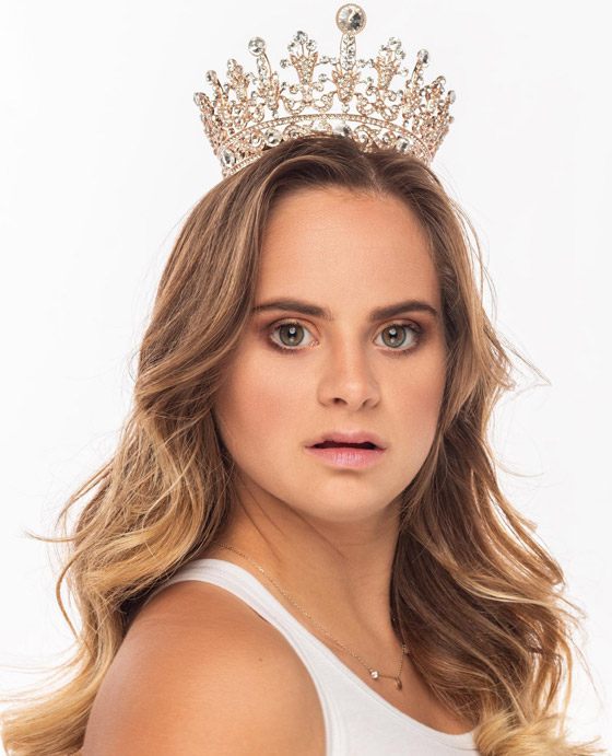 صور: فيكتوريا سيكرت تضم أول عارضة أزياء مصابة بمتلازمة داون صورة رقم 12