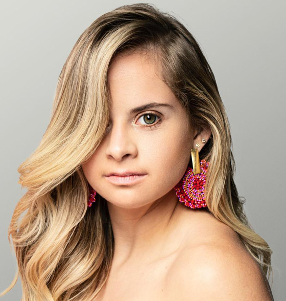 صور: فيكتوريا سيكرت تضم أول عارضة أزياء مصابة بمتلازمة داون صورة رقم 14