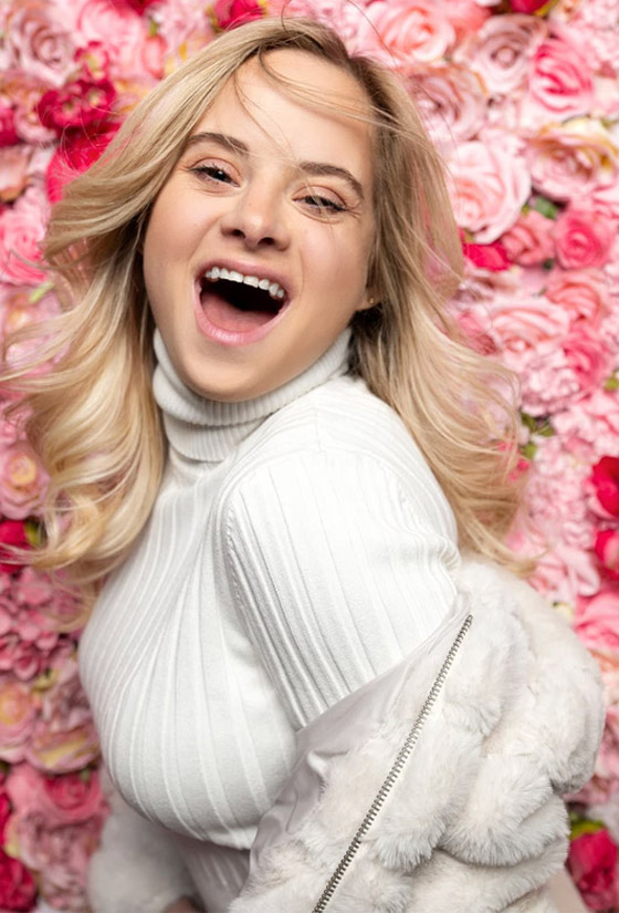 صور: فيكتوريا سيكرت تضم أول عارضة أزياء مصابة بمتلازمة داون صورة رقم 19