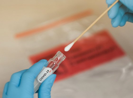 العالم يتعافى من كورونا (كوفيد).. خطوات متسارعة نحو التعايش صورة رقم 7 العالم يتعافى من كورونا (كوفيد).. خطوات متسارعة نحو التعايش صورة رقم 7