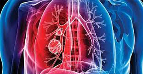لا يقل خطرا عن كورونا.. خبراء يحذرون من إهمال 