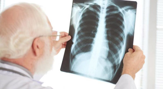 لا يقل خطرا عن كورونا.. خبراء يحذرون من إهمال 