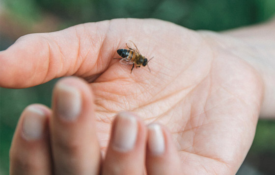 لا تتركها تتهيج وانتبه للحساسية.. علاجات طبية ومنزلية للسعات النحل صورة رقم 8 لا تتركها تتهيج وانتبه للحساسية.. علاجات طبية ومنزلية للسعات النحل صورة رقم 8