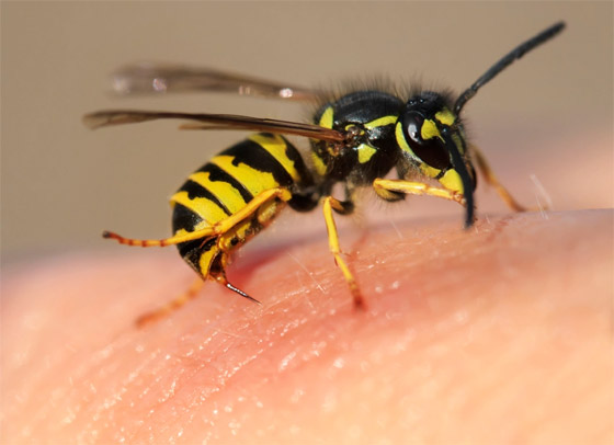 لا تتركها تتهيج وانتبه للحساسية.. علاجات طبية ومنزلية للسعات النحل صورة رقم 5 لا تتركها تتهيج وانتبه للحساسية.. علاجات طبية ومنزلية للسعات النحل صورة رقم 5