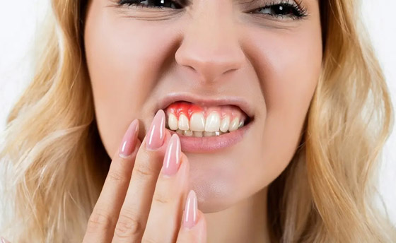 إياكم إهمال صحة الفم.. دراسة تكشف مفاجأة مدوية! صورة رقم 1