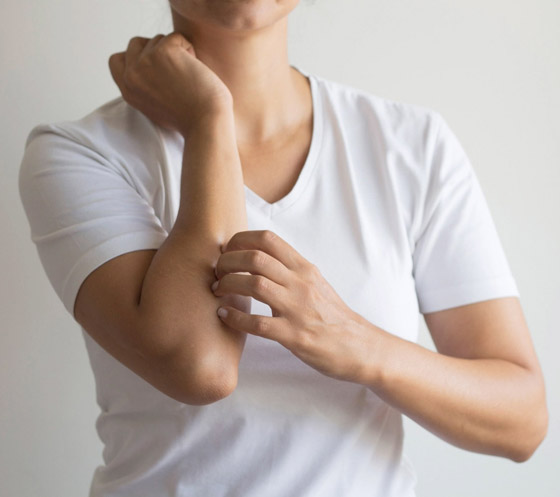 تعاني من الحكة المفاجئة أو طفح جلدي؟ هذه الأطعمة قد تكون السبب..! صورة رقم 1 تعاني من الحكة المفاجئة أو طفح جلدي؟ هذه الأطعمة قد تكون السبب..! صورة رقم 1