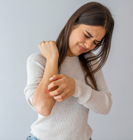 تعاني من الحكة المفاجئة أو طفح جلدي؟ هذه الأطعمة قد تكون السبب..! صورة رقم 2 تعاني من الحكة المفاجئة أو طفح جلدي؟ هذه الأطعمة قد تكون السبب..! صورة رقم 2