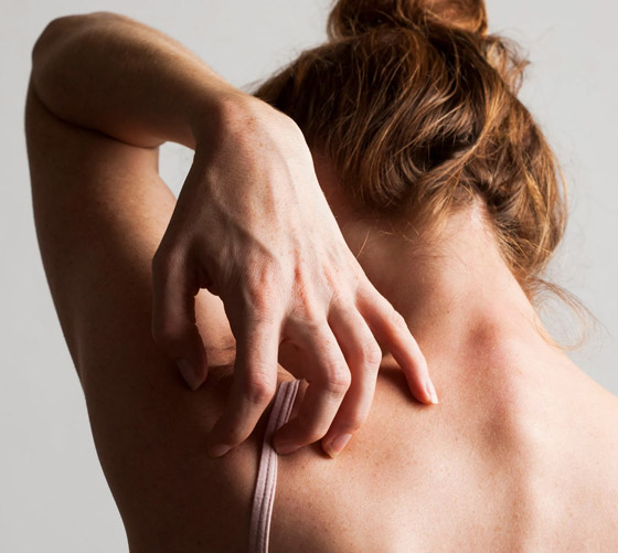 تعاني من الحكة المفاجئة أو طفح جلدي؟ هذه الأطعمة قد تكون السبب..! صورة رقم 6 تعاني من الحكة المفاجئة أو طفح جلدي؟ هذه الأطعمة قد تكون السبب..! صورة رقم 6