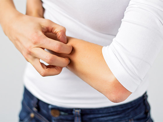 تعاني من الحكة المفاجئة أو طفح جلدي؟ هذه الأطعمة قد تكون السبب..! صورة رقم 7 تعاني من الحكة المفاجئة أو طفح جلدي؟ هذه الأطعمة قد تكون السبب..! صورة رقم 7