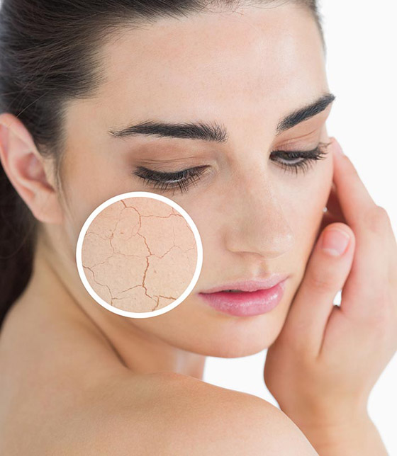 إليك طرق فعالة لعلاج جفاف الوجه الشديد في شهر رمضان صورة رقم 3