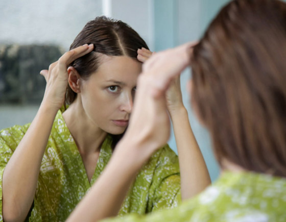 مظهرها يزعجك وتسبب لك الإحراج؟ 8 علاجات طبيعية لفراغات الشعر صورة رقم 1