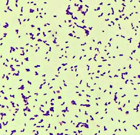 الليستريا: عدوى جديدة تتفشى.. الحوامل أكثر عرضة لخطرها! صورة رقم 6 الليستريا: عدوى جديدة تتفشى.. الحوامل أكثر عرضة لخطرها! صورة رقم 6