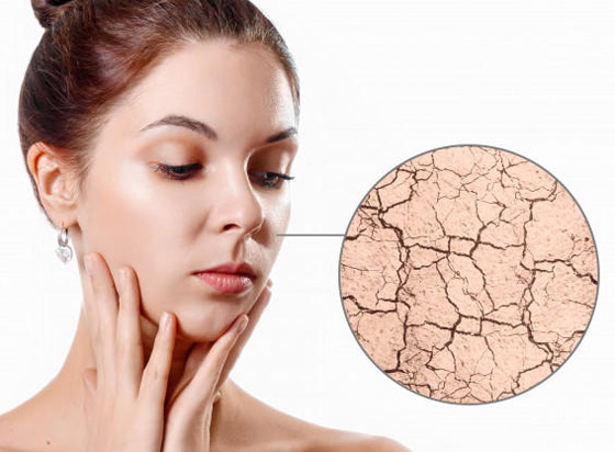 ماسكات طبيعية تخلصك من شحوب البشرة في رمضان صورة رقم 7