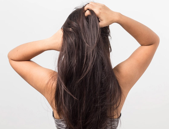 تسبب لك الإحراج؟ إليك 8 علاجات منزلية للتخفيف من حكة الرأس وجفافه صورة رقم 14