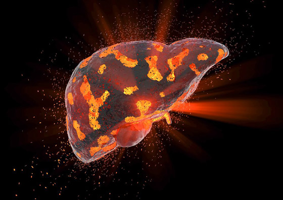 التهاب الكبد الغامض يواصل انتشاره! إصابات جديدة بكندا وآسيا تثير القلق صورة رقم 5 التهاب الكبد الغامض يواصل انتشاره! إصابات جديدة بكندا وآسيا تثير القلق صورة رقم 5