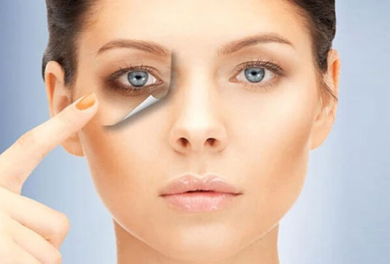 لمن يعاني من الهالات الداكنة.. هذه 9 حلول سحرية مدهشة! صورة رقم 2